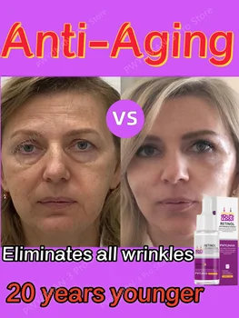 Retinol Anti-Aging Serum Instant Wrinkle Tugevneda Trahvi Read Näo Remont Tõste-Firma Valgendamine Niisutav Korea Care Toode